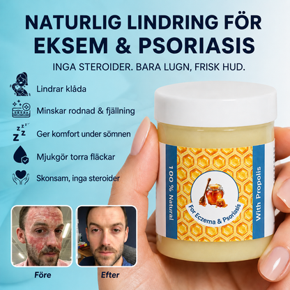 Elvion – Repair Balm För eksem och psoriasis