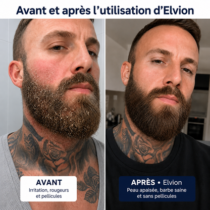 Elvion – Crème Apaisante & Réparatrice