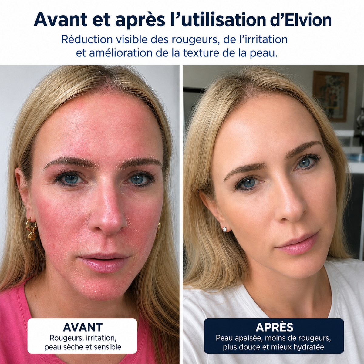 Elvion – Crème Apaisante & Réparatrice