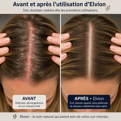 Elvion – Crème Apaisante & Réparatrice