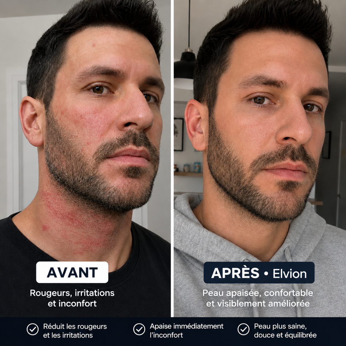 Elvion – Crème Apaisante & Réparatrice
